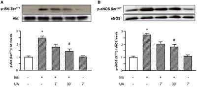 Uric Acid Impairs Insulin Signaling by Promoting Enpp1 Binding to Insulin Receptor in Human Umbilical Vein Endothelial Cells